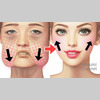 Face Lifting Exercises